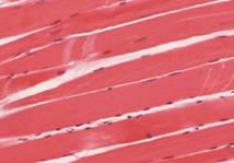 Músculo esquelético. Imagen: OpenStax College - Anatomy & Physiology. Fuente: Wikimedia Commons. Músculo esquelético. Imagen: OpenStax College - Anatomy & Physiology. Fuente: Wikimedia Commons.