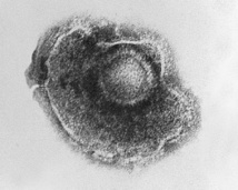 Micrografía del VVZ. Fuente: Wikipedia. Micrografía del VVZ. Fuente: Wikipedia.