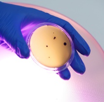 Contaminación microbiana en una placa de agar con una fuente de luz de potencia 405nm al fondo. Fuente: AlphaGalileo.