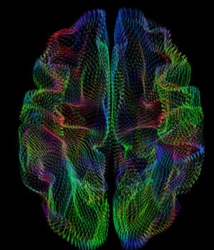 La forma de la corteza cerebral está correlacionada con la ascendencia genética. Fuente: UC San Diego.