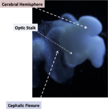 Algunas de las partes del cerebro organoide: hemisferio cerebral, pedúnculo óptico y curva cefálica, todas ellas propias del cerebro fetal. Fuente: OSU.