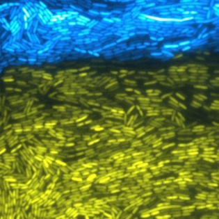 Imagen microscópica que refleja a dos cepas de bacterias modificadas sintéticamente cooperando. Imagen cortesía del Bennett Lab. Fuente: Universidad Rice.