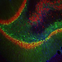 Las células verdes muestran dónde los investigadores utilizaron un virus inyectado para bloquear la producción de FGF9 en cerebros de ratas. Fuente: University of Michigan
