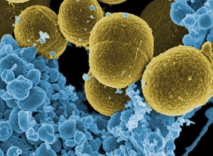 Bacterias 'Staphylococcus aureus' escapando de la destrucción por células blancas humanas. Fuente: Wikipedia.