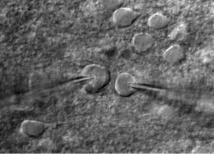 Células aisladas en la corteza visual de un ratón. Fuente: Alfredo/Kirkwood (JHU) Células aisladas en la corteza visual de un ratón. Fuente: Alfredo/Kirkwood (JHU)