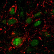 En verde, neuronas de la amígdala central de las ratas activadas por las proteínas de la E. coli. Imagen: J. Breton, N. Lucas & D. Schapman. Fuente: Cell Press.