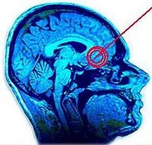 La neurociencia puede contribuir a la comprensión de la espiritualidad humana La neurociencia puede contribuir a la comprensión de la espiritualidad humana
