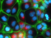Hepatocitos etiquetados con fluorescencia de Upcyte. Imagen: Yaakov Nahmias. Fuente: Universidad Hebrea de Jerusalén.