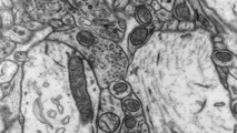 Mitocondrias en las neuronas del nucleus accumbens. Imagen: Graham Knott. Fuente: EFPL.