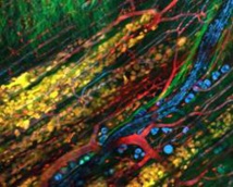 Invasión colectiva de células tumorales (en amarillo) en la piel de un ratón. Las células siguen el camino de los nervios y del tejido adiposo (en azul), del tejido conectivo y muscular (en verde); y de los vasos sanguíneos (en rojo).  Fuente: Universidad de Radboud/Alphagalileo.