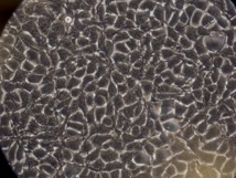 Células bajo el microscopio. Fuente: Universidad de Washington.