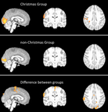 Activación cerebral en el grupo navideño (arriba), el no-navideño (centro), y diferencias entre ambos (abajo). Fuente: BMJ. Activación cerebral en el grupo navideño (arriba), el no-navideño (centro), y diferencias entre ambos (abajo). Fuente: BMJ.