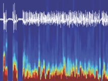 Señales cerebrales EEG registradas de ratón, mientras este se despertaba de la anestesia gracias a la estimulación con optogenética del circuito cerebral encontrado. Fuente: Universidad de Berna.
