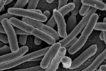 Microbios al microscopio. Fuente: Niaid (Instituto Nacional de Alergias y Enfermedades Infeciosas estadounidense).