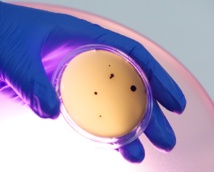 Contaminación microbiana en una placa de agar. Fuente: AlphaGalileo. Contaminación microbiana en una placa de agar. Fuente: AlphaGalileo.