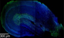 Imagen que muestra las neuronas inhibitorias LRIPs (en verde) extendiéndose desde la corteza entorrinal (en la parte inferior derecha) hacia el hipocampo. Se ha descubierto que las LRIPs forman parte de un sofisticado mecanismo crítico en la formación de recuerdos de contexto. Imagen:  Jayeeta Basu. Fuente: Mortimer B. Zuckerman Mind Brain Behavior Institute.