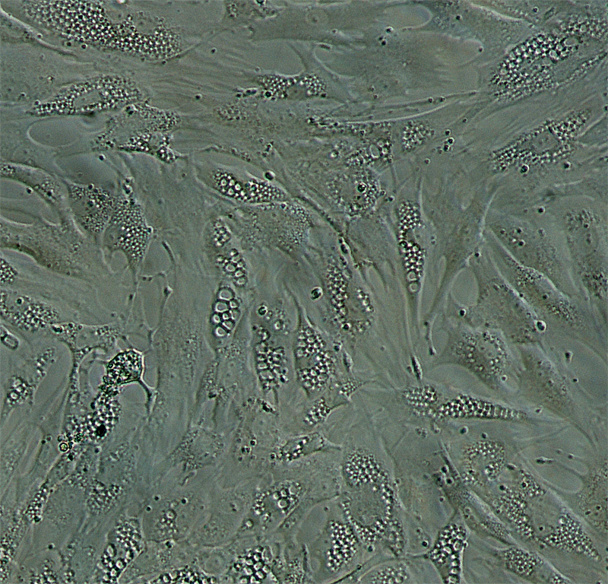 Vista al microscopio de adipocitos inmaduros. Fuente: UGR.