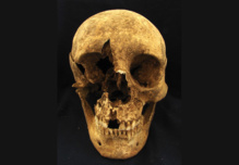 Calavera de uno de los esqueletos hallados en el cementerio romano de Casal Bertone. Imagen: Kristina Killgrove. Fuente: Sinc. Calavera de uno de los esqueletos hallados en el cementerio romano de Casal Bertone. Imagen: Kristina Killgrove. Fuente: Sinc.