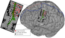 Matriz de electrodos implantada en el cerebro, así como aquellos (los puntos rojos) que controlan los dedos. Imagen: G. Hotson. Fuente: Universidad Johns Hopkins.