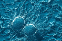 Fuente: ReAnima. Fuente: ReAnima.