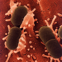 Escherichia coli. Fuente: Kimicontrol.