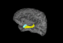 Imagen cerebral en la que aparecen coloreadas la amígdala (azul) y el hipocampo (amarillo). Imagen: Stephan Moratti. Fuente: UPM.