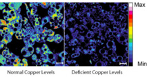 Niveles normales (izda.) y deficientes (dcha.) de cobre en los adipocitos. Los colores cálidos indican niveles altos. Imagen: L. Krishnamoorthy/J. Cotruvo. Fuente: UC Berkeley.