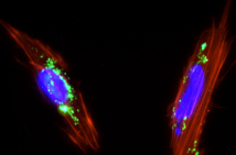 Células mesenquimales de placenta con nanopartículas de sílice mesoporosa (color verde) internalizadas en su citoplasma. Imagen: Juan Luis Paris. Fuente: UCM.