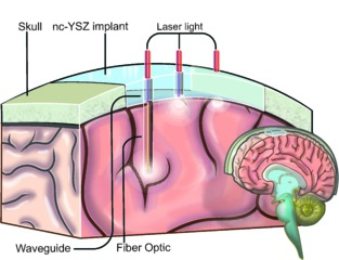 Funcionamiento de la 'ventana al cerebro'. Fuente: UCR. Funcionamiento de la 'ventana al cerebro'. Fuente: UCR.