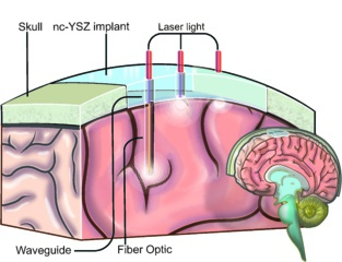 Funcionamiento de la 'ventana al cerebro'. Fuente: UCR.