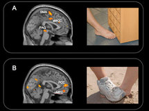 Regiones del cerebro relacionadas con el procesamiento del dolor y de los juicios morales activadas ante la visión del dolor ajeno. Fuente: Universidad de Chicago.