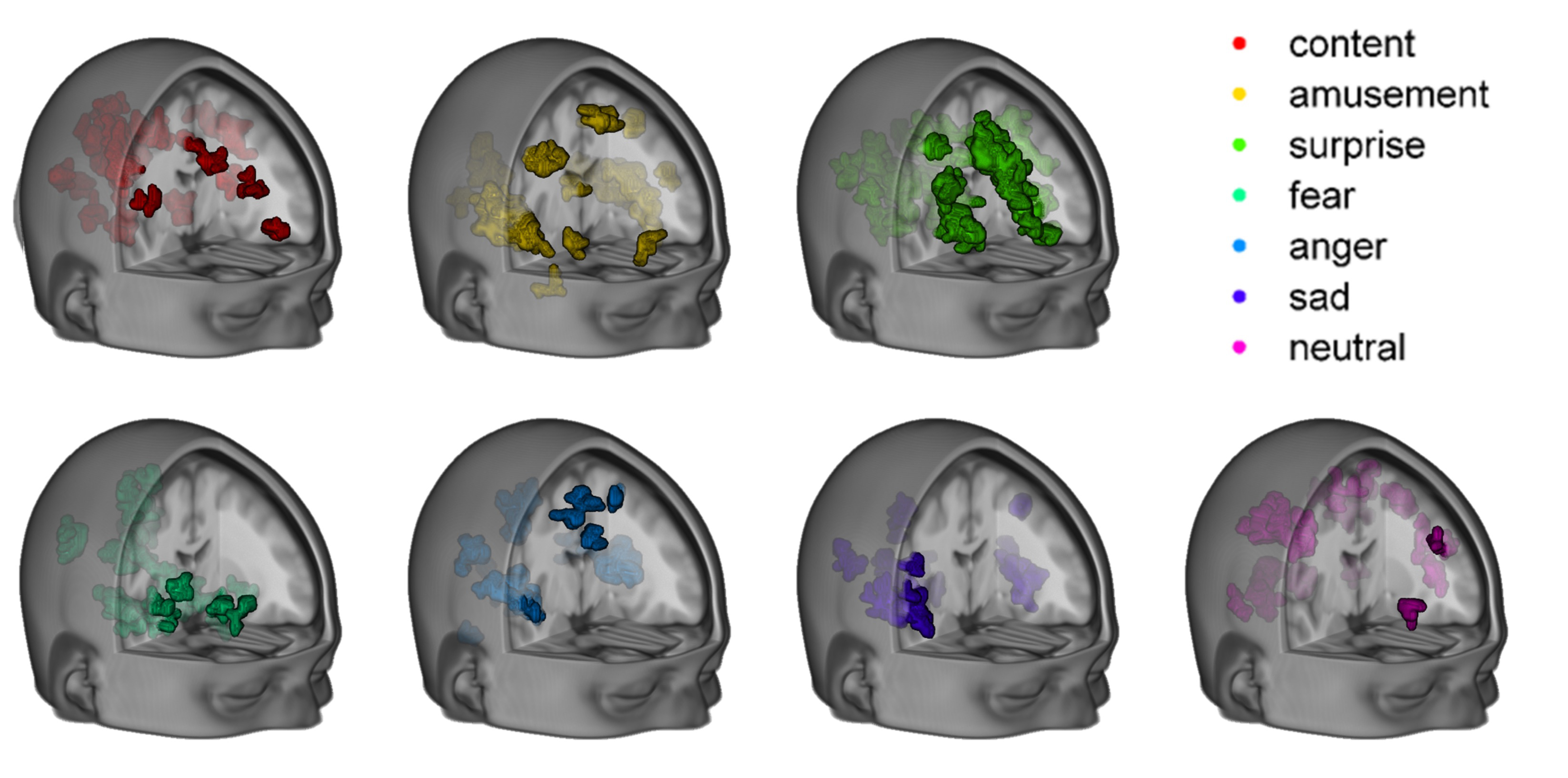 Siete emociones, en el cerebro: alegría (rojo), diversión (amarillo), sorpresa (verde), miedo (verde fluorescente), enfado (azul), tristeza (morado) y neutral (rosa). Imagen: Philip Kragel/K. LaBar. Fuente: Universidad Duke.