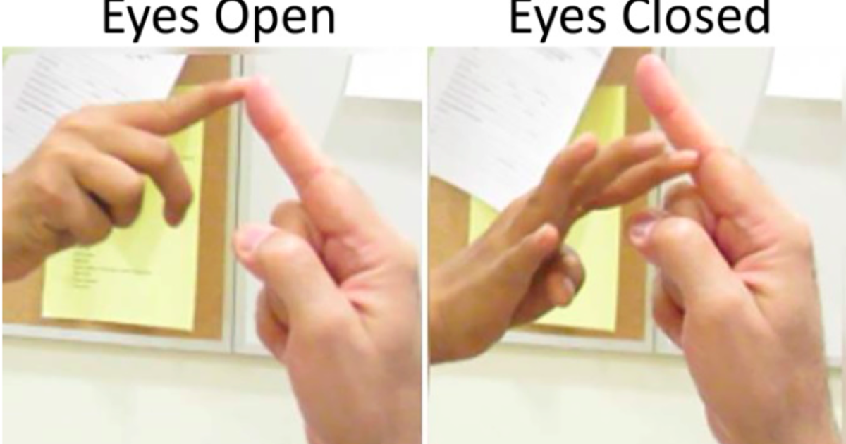 Los pacientes con una mutación en el gen PIEZO2 no aciertan a juntar sus dedos índices con los ojos cerrados. Imagen: Laboratorio Bonnemann. Fuente: NIH/NINDS.