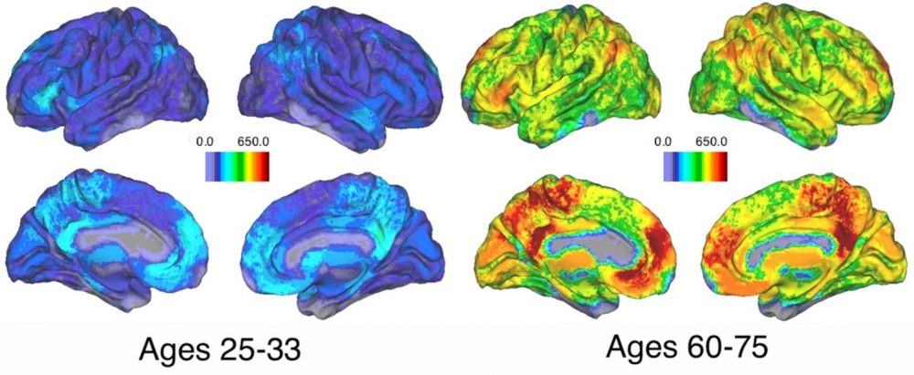 Los grupos de regiones del cerebro que sincronizan su actividad durante las tareas relacionadas con la memoria se hacen más pequeños y más numerosos con la edad. Imagen: UCSB