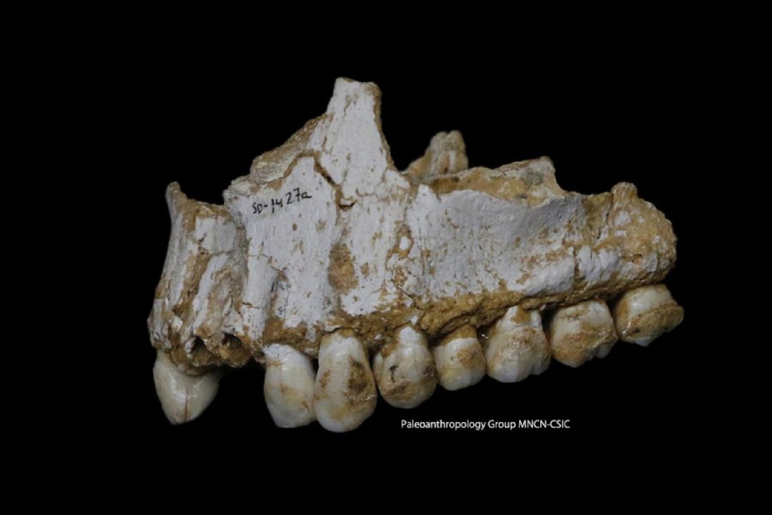 Mandíbula neandertal hallada en El Sidrón. En el molar trasero derecho se puede apreciar un depósito de cálculo dental que revela que este individuo consumía álamo y el hongo Penicillium, fuente de un antibiótico natural. Fuente: Paleoanthropology Group MNCN-CSIC.