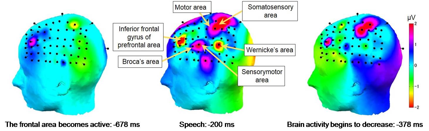 Cambios en la actividad cerebral (promedio de 10 sílabas para 8 sujetos). Crédito: Universidad Tecnológica de Toyohashi