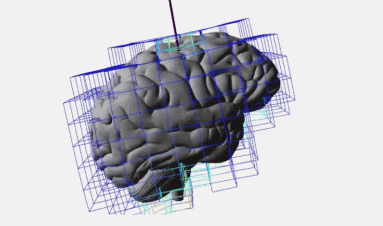 Imagen del sistema desarrollado para ayudar a los neurocirujanos. Foto: Universidad de Luxemburgo.