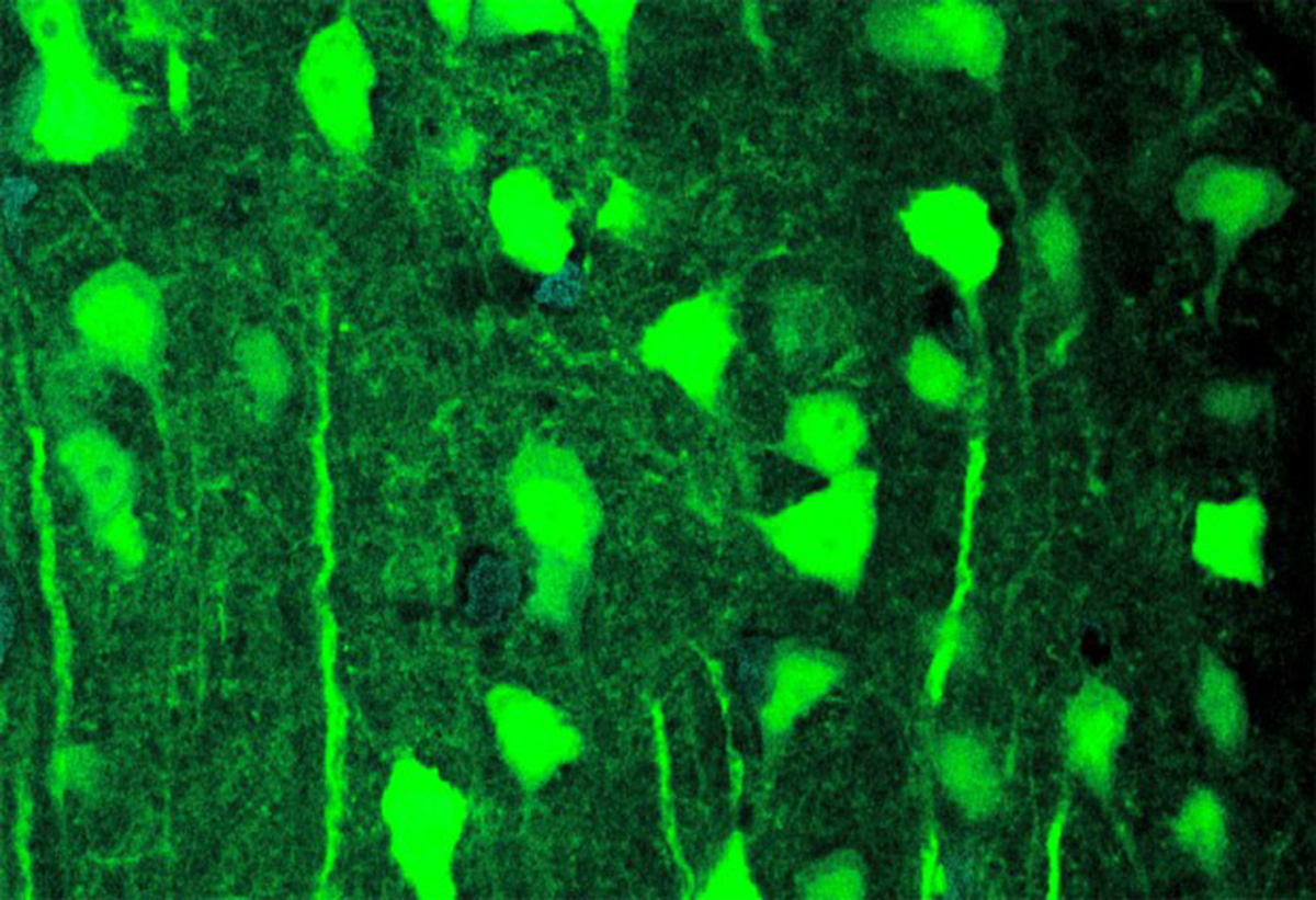 Las proteínas fotosensibles insertadas en las neuronas relacionadas con la reacción a estímulos externos, apreciables en verde fluorescente. Foto: Franz Villaruel. Concordia University.