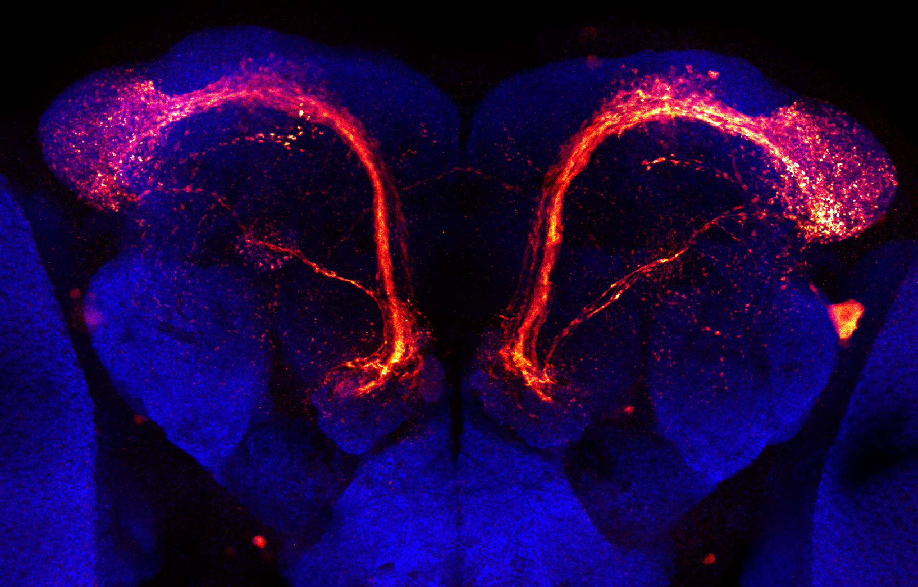 Neuronas vulnerables en el cerebro de la mosca de la fruta. Crédit:TUM Fotostelle.