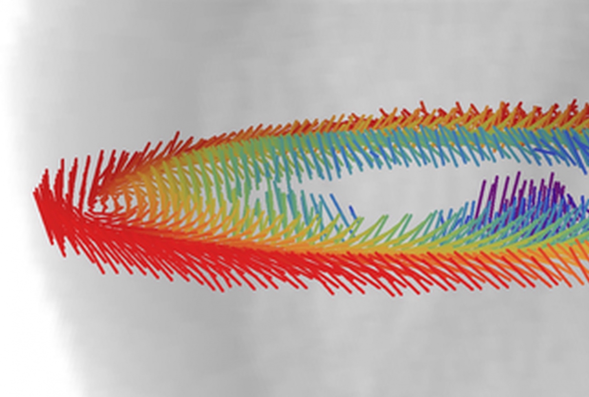 En esta imagen se aprecia, en colores vivos, la orientación helicoidal de las fibras de la pared ventricular en el tejido cardiaco de una rata, examinado mediante imágenes de resonancia magnética. Foto: Shape Analysis Group/McGill University.