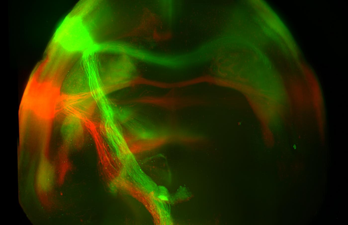 Las proyecciones neuronales de la corteza cerebral dulce (verde) y amarga (roja) terminan en objetivos distintos en la amígdala del cerebro de los ratones. Imagen: Li Wang / Zuker Lab / Instituto Zuckerman de Columbia.