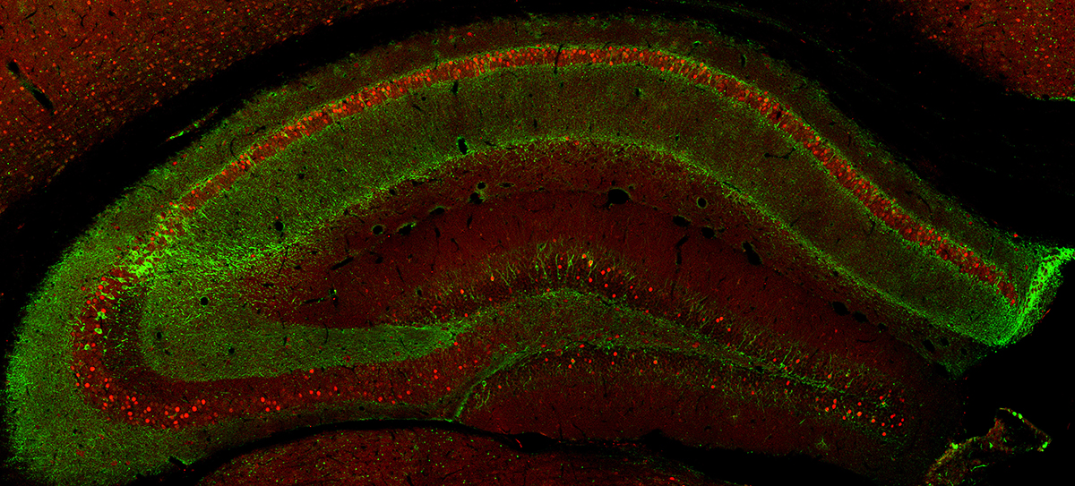 Sección transversal del hipocampo del ratón: en verde se aprecian las neuronas que están activas cuando los ratones recuerdan una memoria traumática de un mes. Y en rojo se ven las neuronas que están activas cuando los ratones se sometieron a un entrenamiento para olvidar recuerdos dolorosos. Crédito: EPFL / Gräff Group.