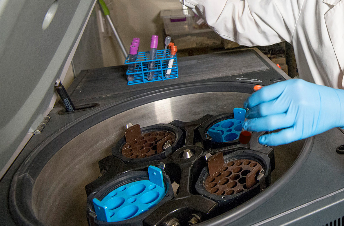 Una muestra de sangre es analizada en el Laboratorio del Sueño de  la Universidad de Washington. Foto: WSU Health Sciences Spokane.