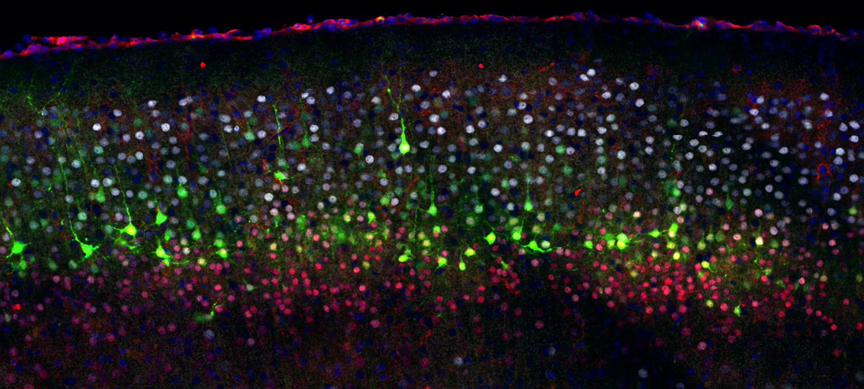 La diversidad de neuronas corticales puede visualizarse a través de diferentes marcadores moleculares, que muestran células con diferente morfología y conectividad.© UNIGE.