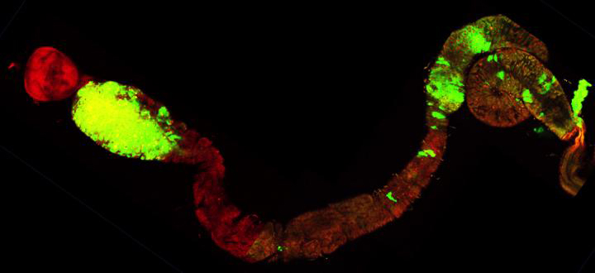 Tubo disgestivo de la mosca Drosophila melanogaster presentando células tumorales (en verde). Un tumor denso (izquierda) está situado en la porción anterior del intestino medio. © Andreu Casali. CNRS.