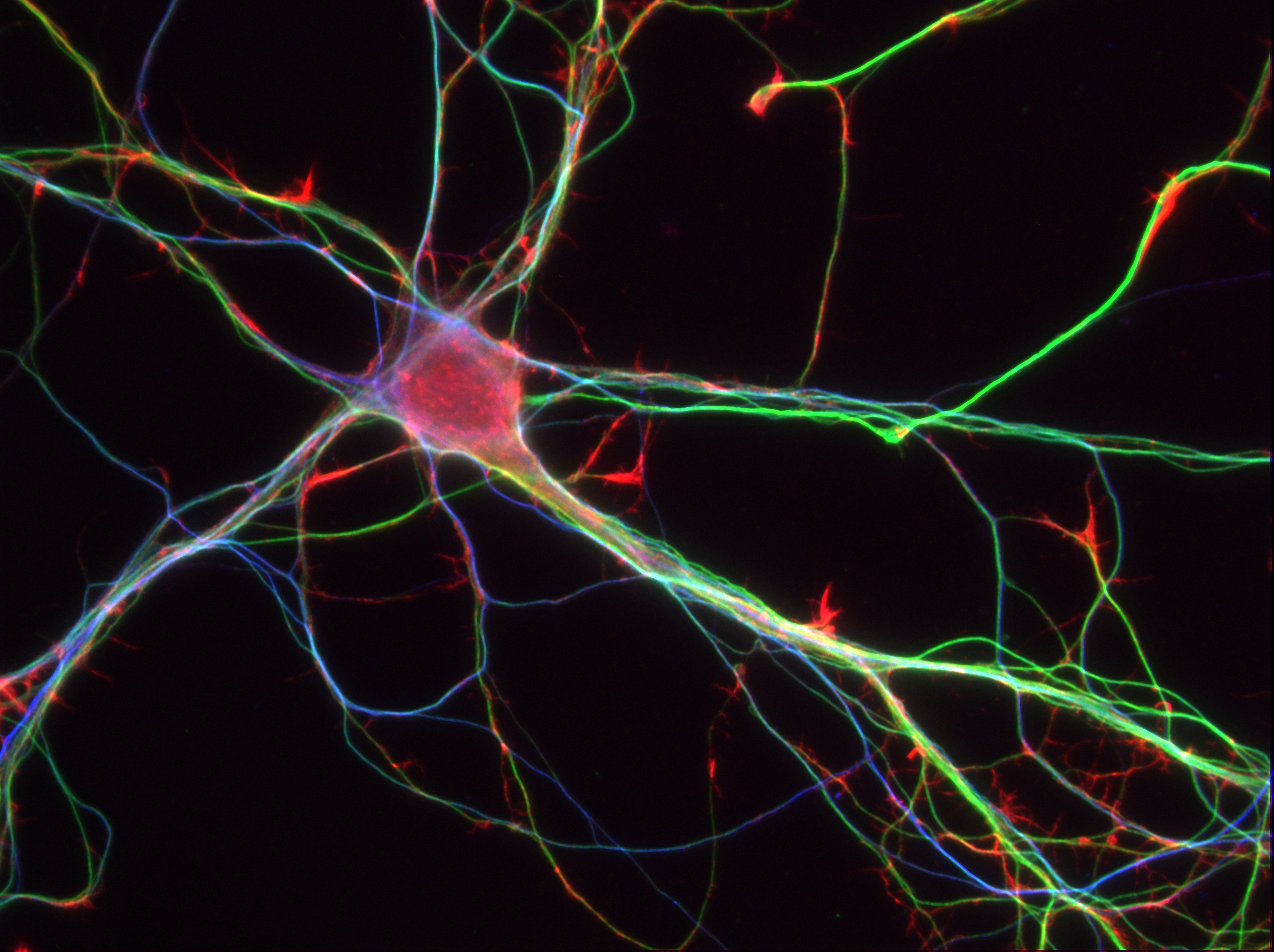 Neurona del hipocampo. Crédito: Inserm/Peris, Leticia