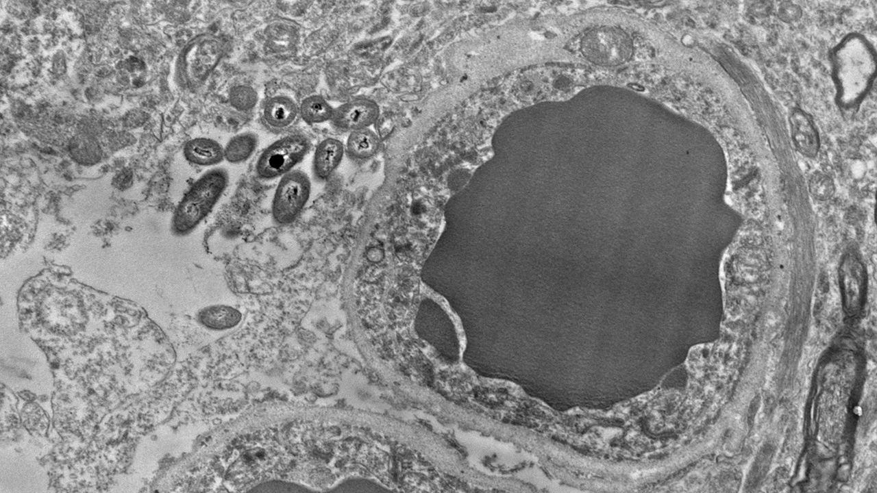 Bacterias intestinalis aparecen a la izquierda en esta imagen de cortes del cerebro humano. Foto: Rosalinda Roberts, Courtney Walker y Charlene Farmer.