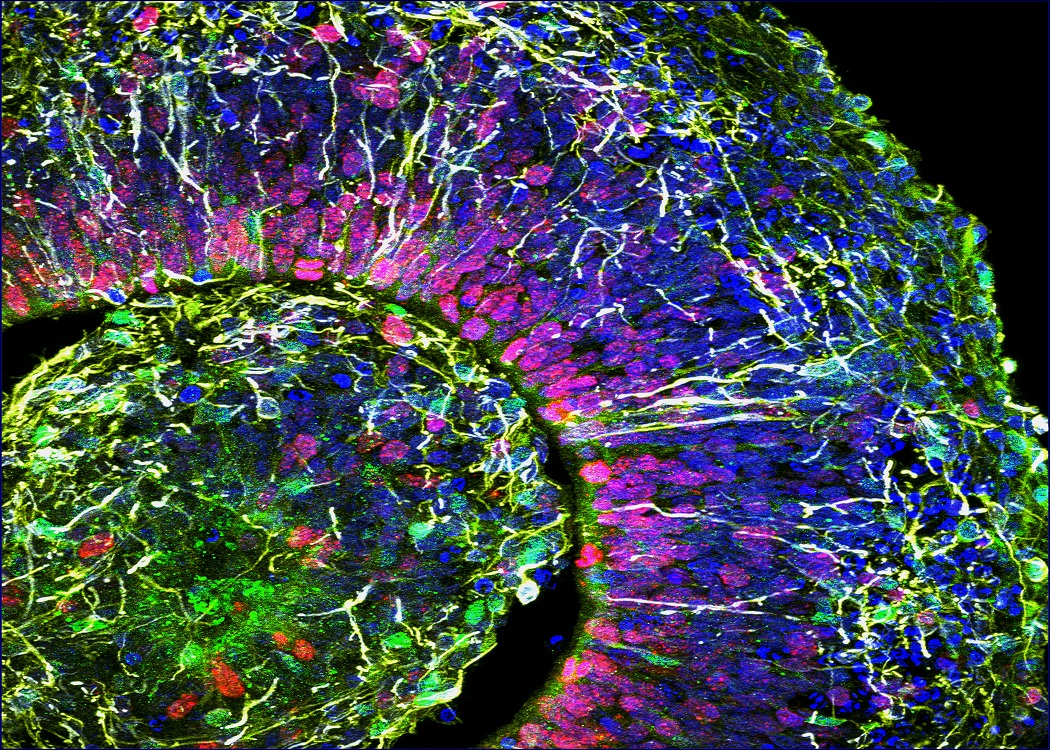 Falso color de una porción de organoide cerebral humano de un paciente con trastorno del espectro autista. Forto: Alysson Muotri, UC San Diego Health.