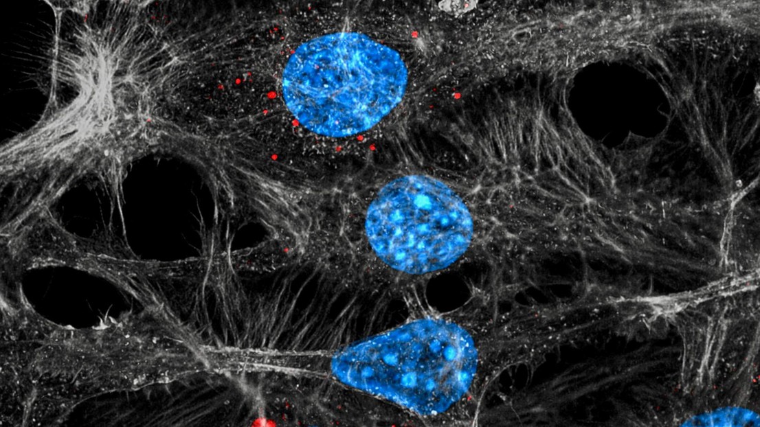 Células endoteliales (azul/gris) que internalizan los exosomas (rojos) liberados de los tumores tratados con quimioterapia (credito: C. Cianciaruso/I. Keklikoglou)