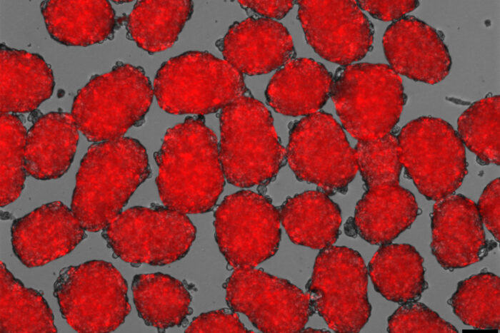 Las nuevas células beta aparecen rojas, ya que segregan insulina en respuesta a la glucosa. Imagen: Washington University.